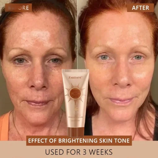 Zakdavi™ Radiant Whitening & Spot Eraser Mask