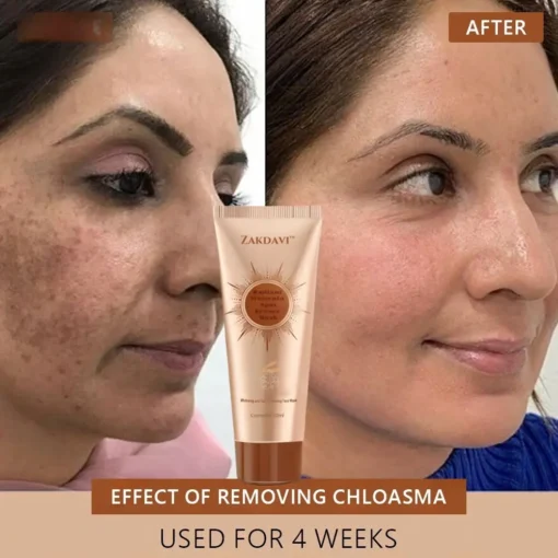 Zakdavi™ Radiant Whitening & Spot Eraser Mask