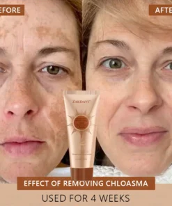 Zakdavi™ Radiant Whitening & Spot Eraser Mask