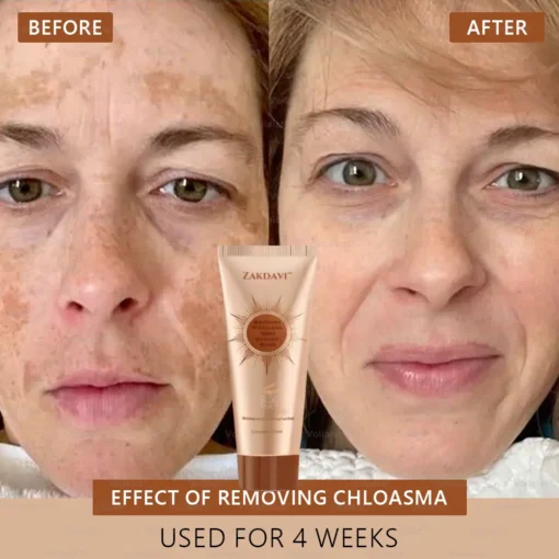 Zakdavi™ Radiant Whitening & Spot Eraser Mask