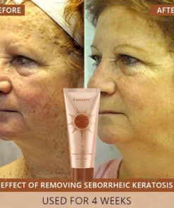 Zakdavi™ Radiant Whitening & Spot Eraser Mask