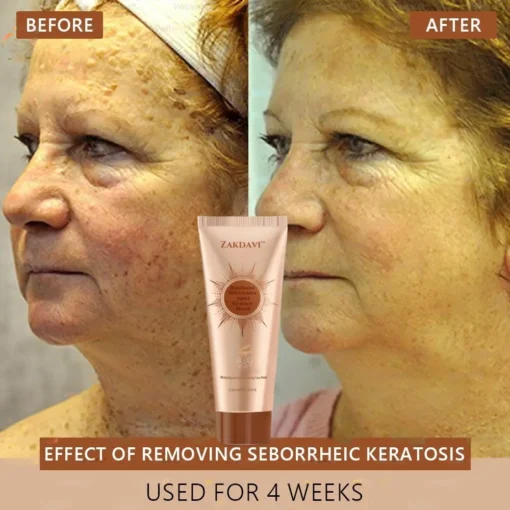 Zakdavi™ Radiant Whitening & Spot Eraser Mask