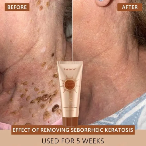 Zakdavi™ Radiant Whitening & Spot Eraser Mask