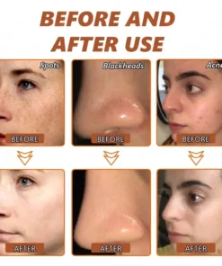 Zakdavi™ Radiant Whitening & Spot Eraser Mask