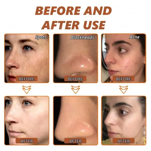 Zakdavi™ Radiant Whitening & Spot Eraser Mask